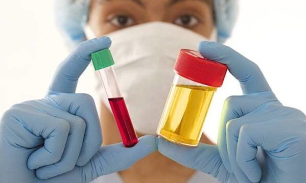 Εξετάσεις αίματος και ούρων πριν από την επέμβαση διεύρυνσης του μαστού